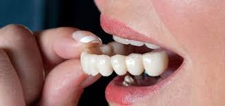 Dental teeth cast models used to plan crowns and bridges