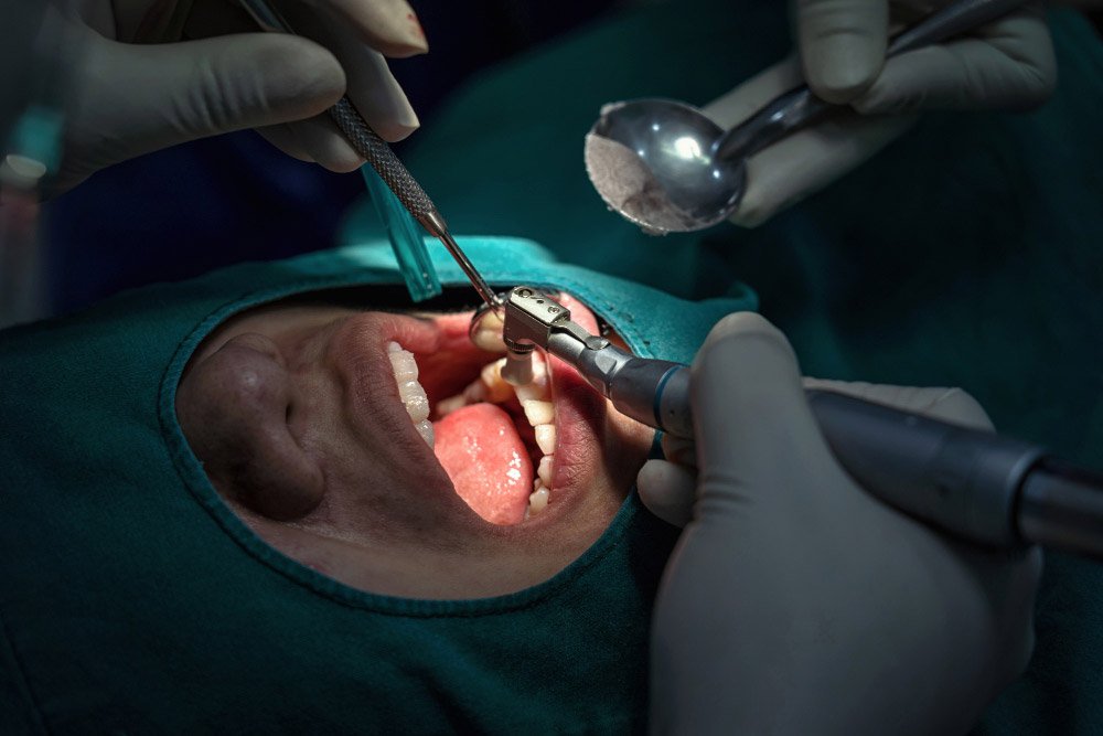 Dental treatment room prepared for a tooth extraction or minor oral surgery